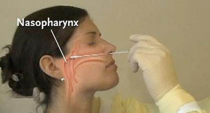 37+ Covid Test Kit Swab Gif